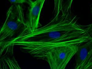 Test sanguin d'immunofluorescence