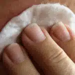 Peeling Lyon
