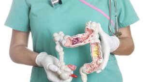 maladie de Crohn